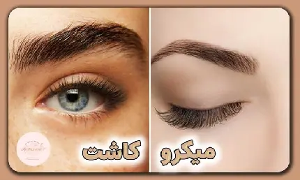 بررسی تخصصی: زیباترین فرم ابرو با کدام روش به دست می‌آید؟ کاشت ابرو یا میکرو؟
