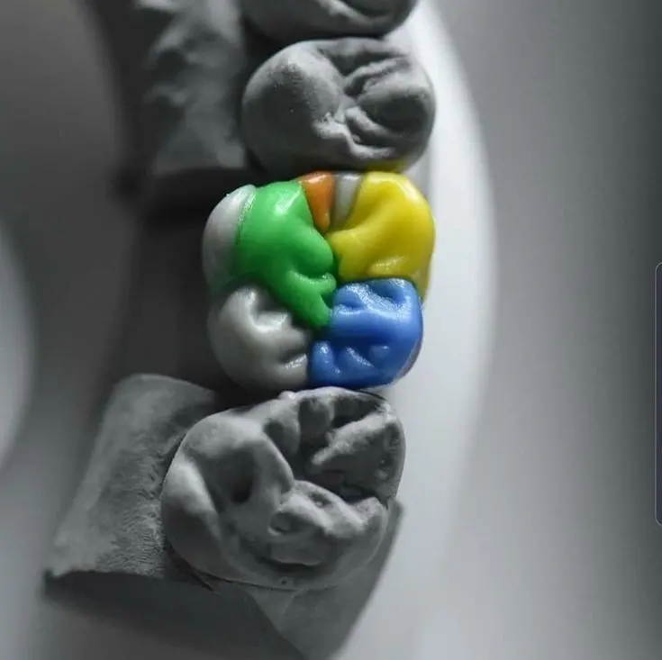 عکس روز جهانی دندان درد national toothache day