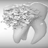 چاپ قاب موبایل و گوشی عکس دندان سفید رنگ در حال ریزش برای روز جهانی دندانپزشک