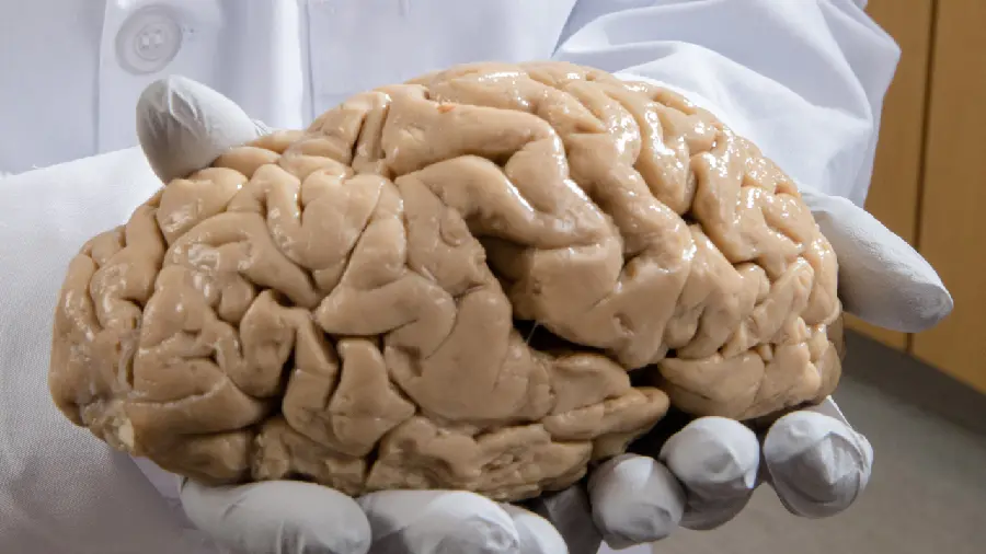 عکس مغز واقعی انسان در دست دکتر مغز و اعصاب
