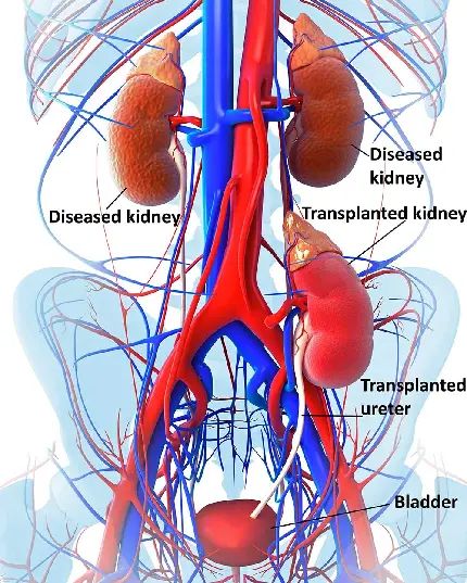 عکس رنگی کلیه و مجاری ادراری با کیفیت خیلی عالی