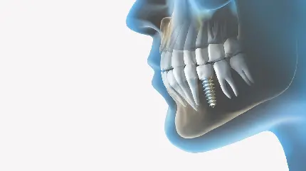 عکس جالب و فانتزی دندان مصنوعی برای پوستر مطب دندانپزشکی