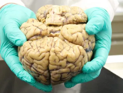 عکس مغز انسان واقعی