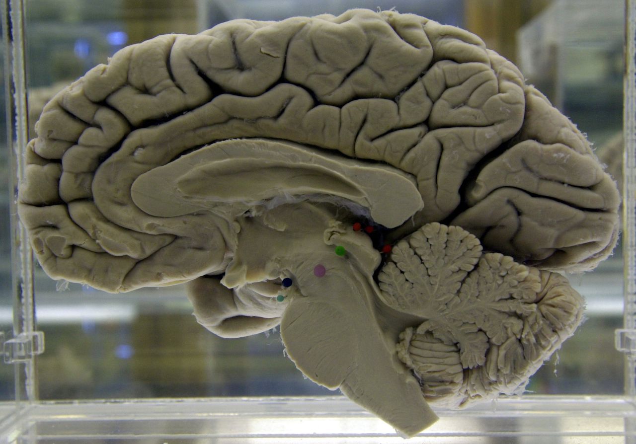 عکس تکه شده مغز انسان به دو نصف در آب