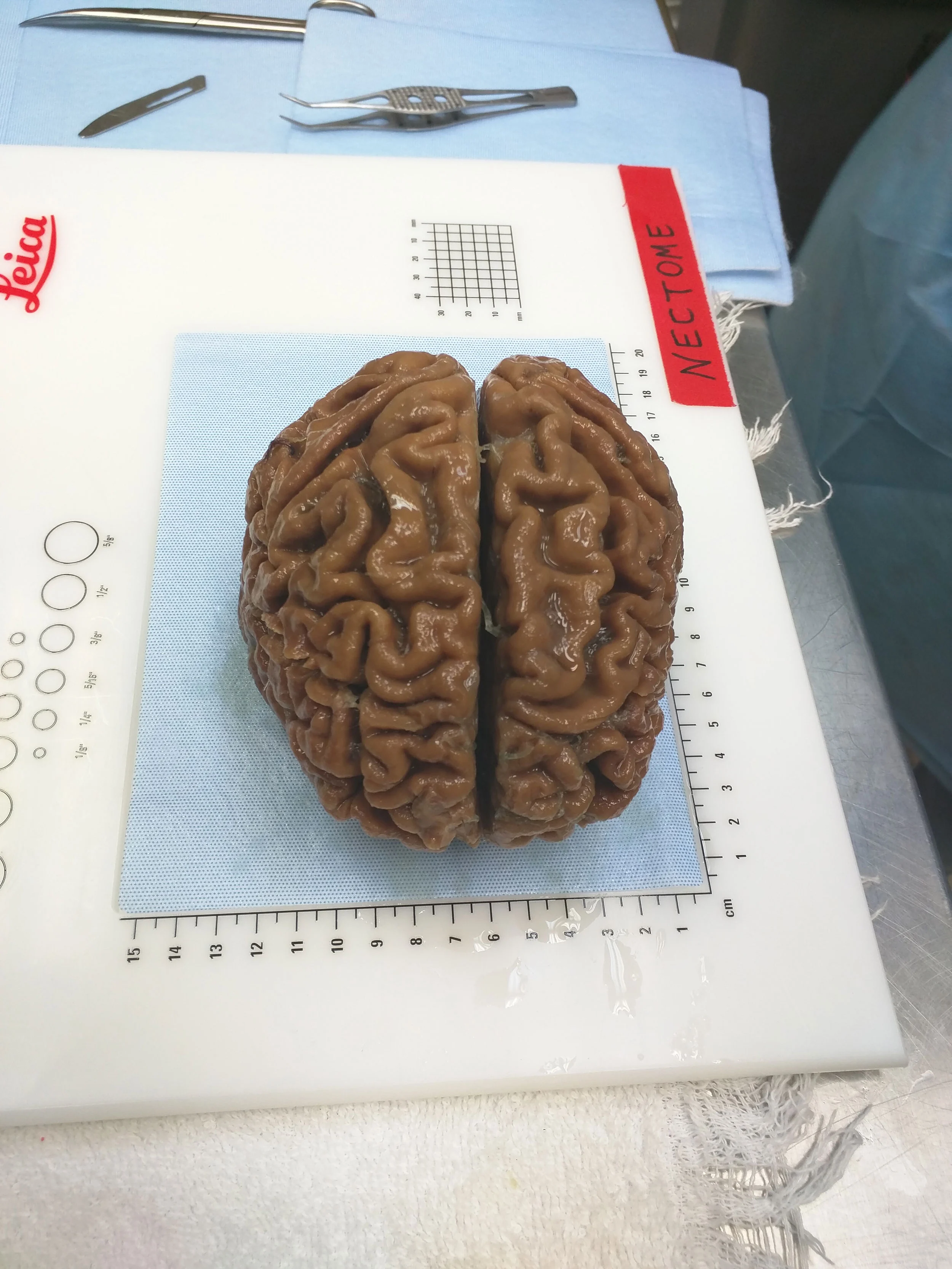 عکس ترسناک و علمی مغز انسان واقعی