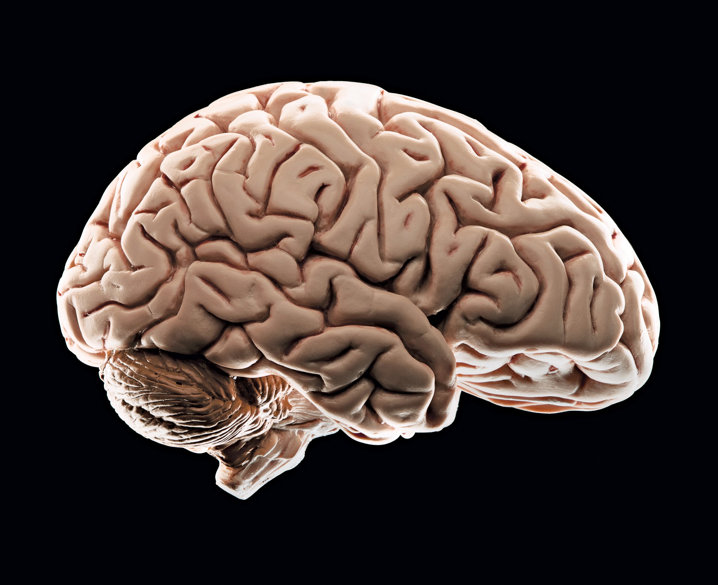 عکس مغز انسان ها