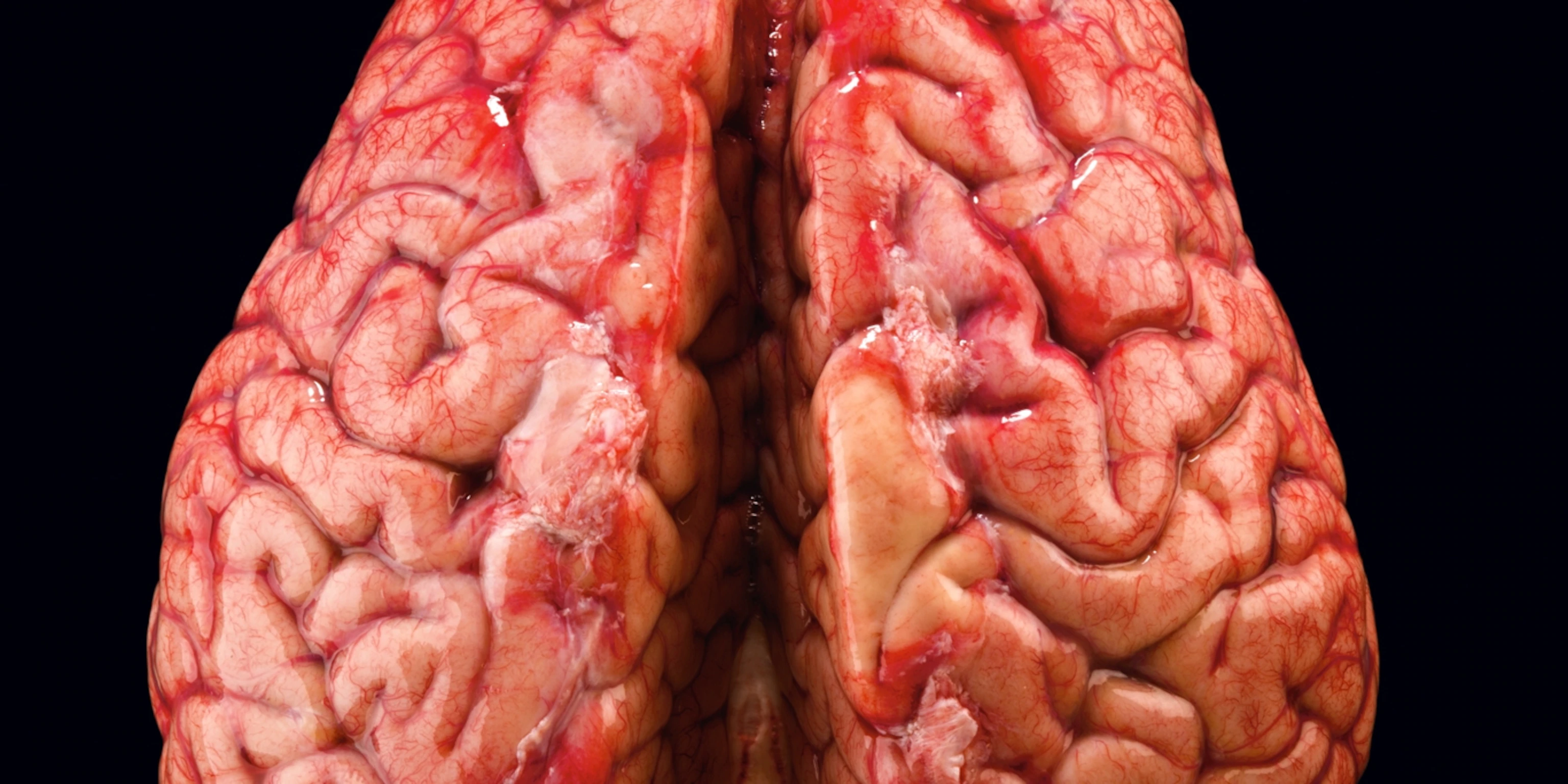 عکس نزدیک شده و واقعی مغز انسان با کیفیت حیرت انگیز