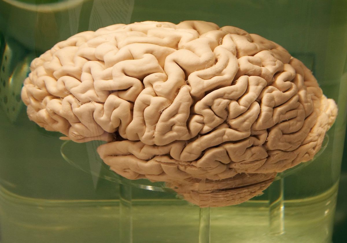 عکس مغز واقعی انسان در آب عجیب و غریب