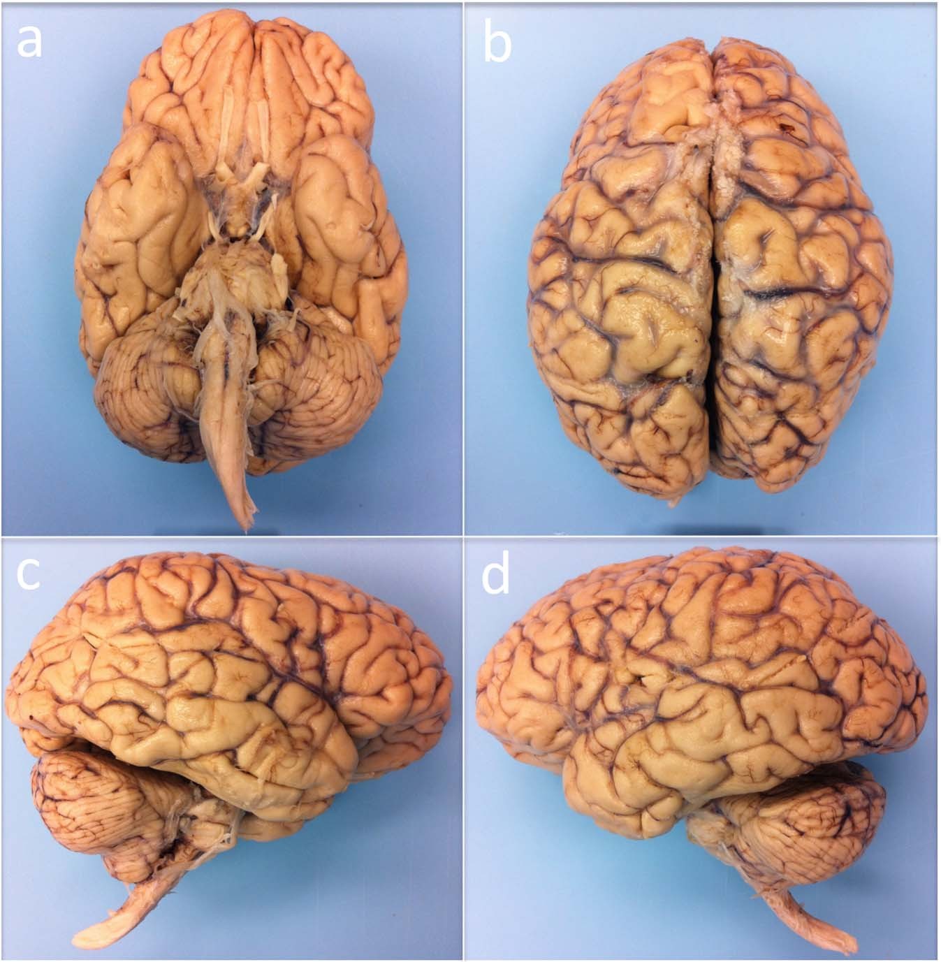 عکس از مغز انسان واقعی