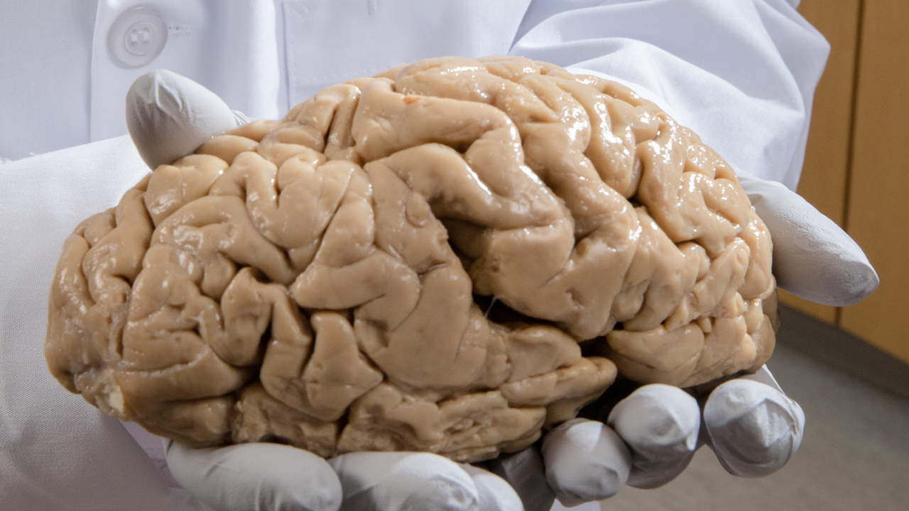 عکس مغز واقعی انسان در دست دکتر مغز و اعصاب