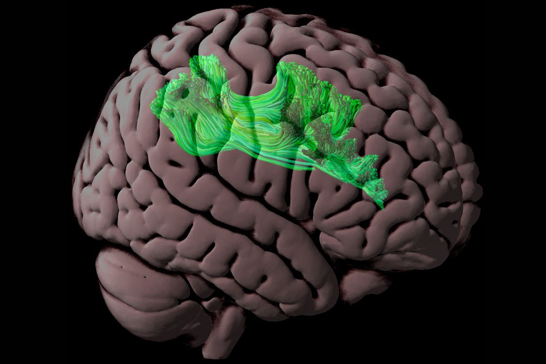 عکس مغز انسان ساخته شده با خمیر مجسمه سازی