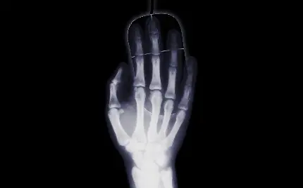 عکس رادیولوژی دست روی موس کامپیوتر برای والپیپر گیمری