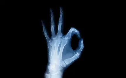 عکس سه بعدی جالب از رادیولوژی دست چپ با نماد اوکی
