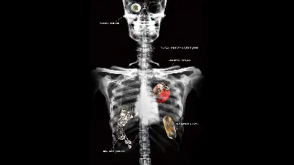 تصویر حیرت برانگیز از رادیولوژی انسان با جوارح مصنوعی