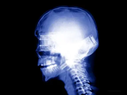 جالب ترین عکس رادیولوژی از سر و گردن با کیفیت ویژه