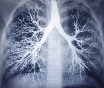 عکس رادیولوژی ریه و دستگاه تنفسی انسان