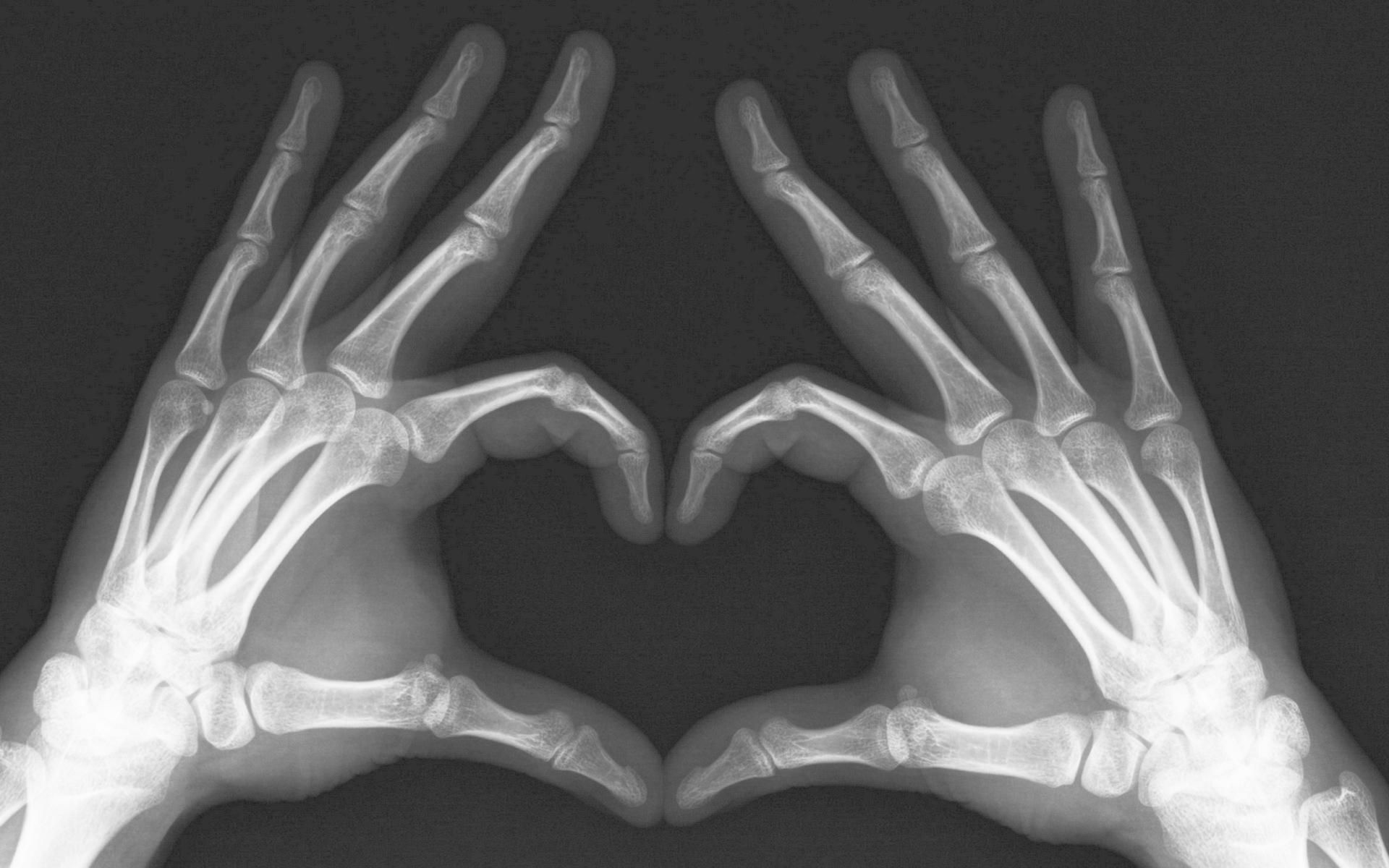 عکس رادیولوژی دست در حال نشان دادن قلب برای پروفایل