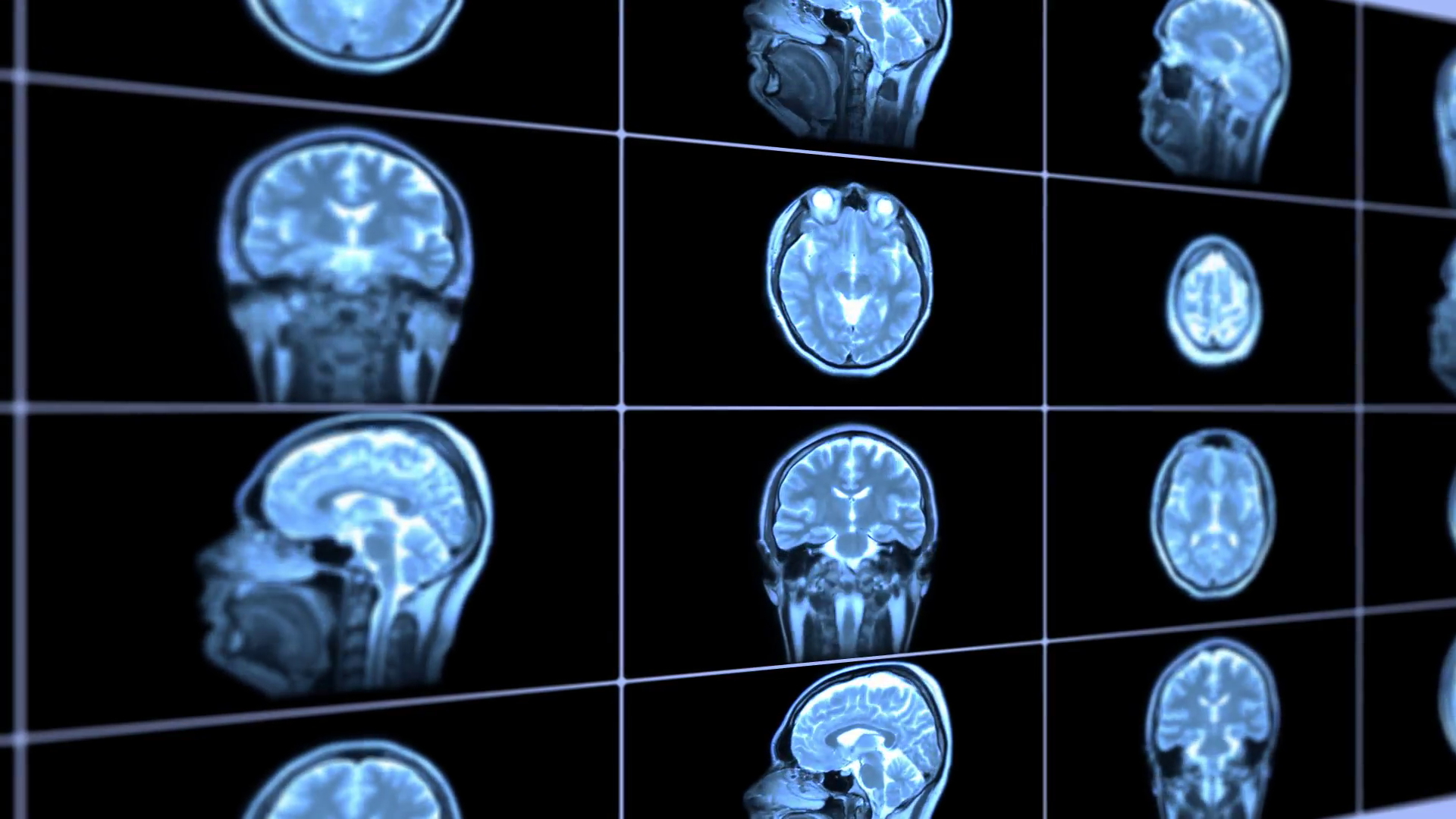 عکس رادیولوژی بسیار زیبا و دقیق از قسمت‌ های مختلف مغز