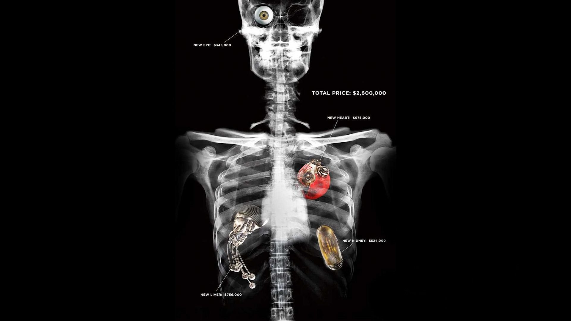 تصویر حیرت برانگیز از رادیولوژی انسان با جوارح مصنوعی