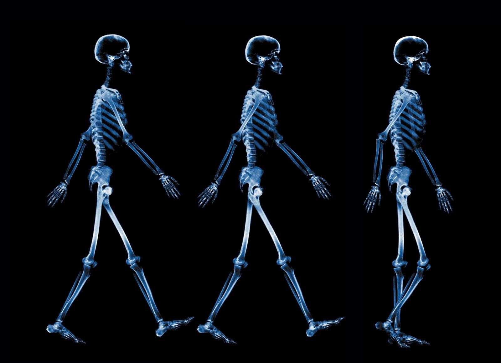 رادیولوژی ۳ بخشی قدم زدن انسان با کیفیت بالا برای چاپ
