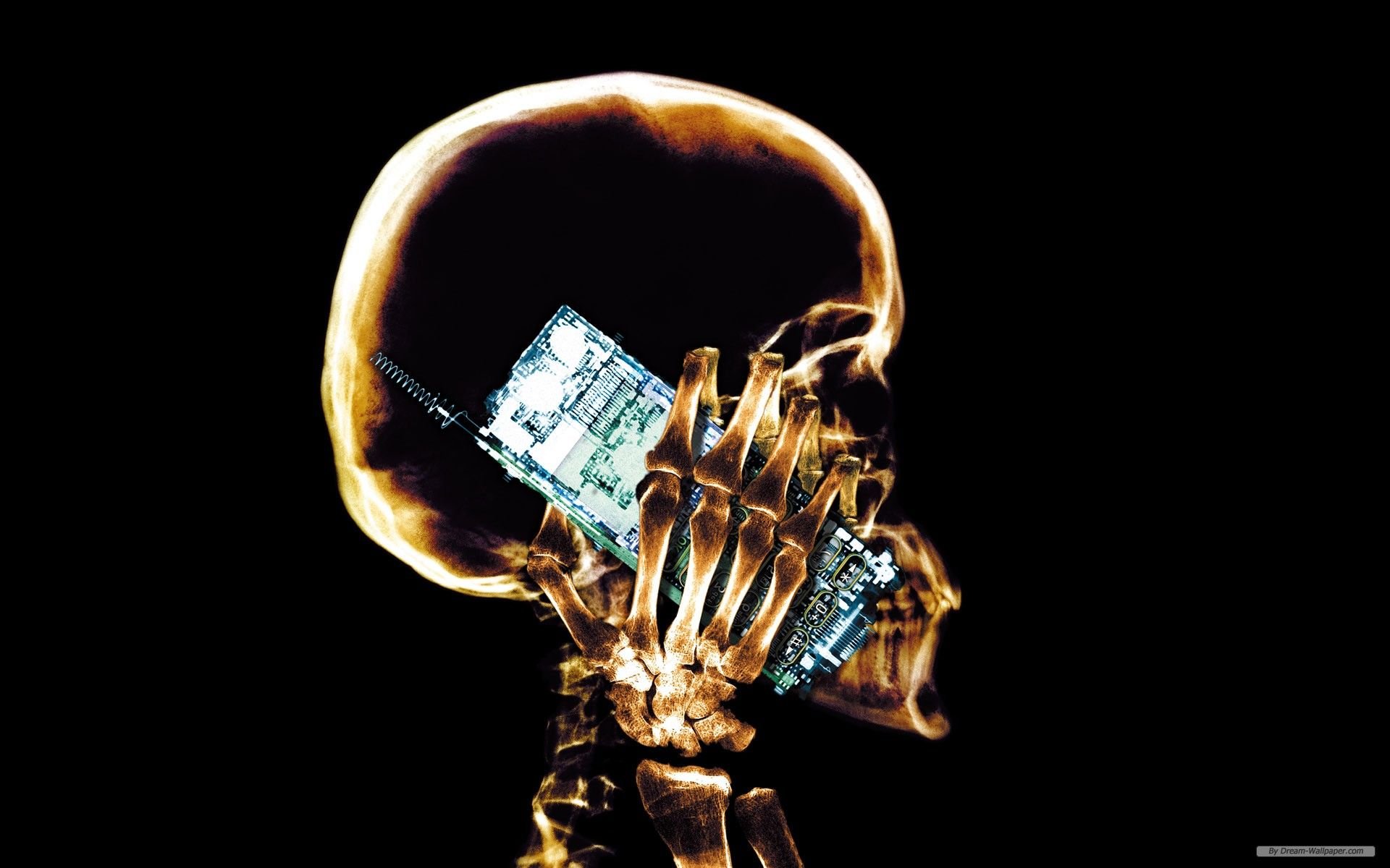 عکس رادیولوژی واقعی از انسان در حال مکالمه با موبایل