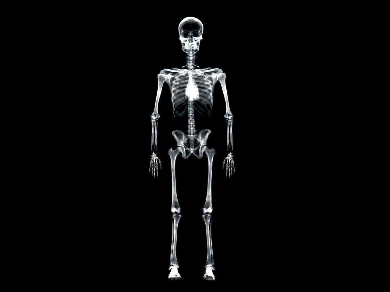 تصویر رادیولوژی بدن کامل انسان با کیفیت اصلی 1401