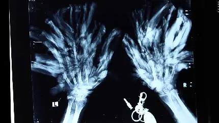 تصویر پروفایل جاب اکس ری x-ray درخت های پر شاخه 