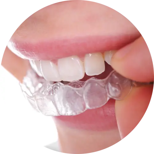 پرکاربردترین تصویر PNG پی ان جی ارتودنسی نامرئی دندان 