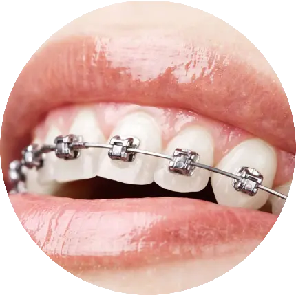 عکس با فرمت PNG جدید ارتودنسی دندان برای طراحی و ادیت