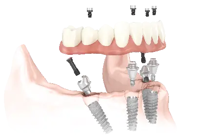 تصویر گرافیکی دور بری شده پی ان جی png دندان کیفیت بالا 