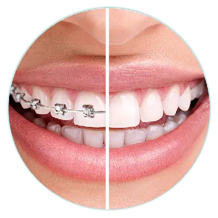 عکس پروفایل ارتودنسی دندان مخصوص متخصص های ارتودنسی