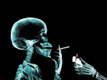 عکس رادیولوژی جالب و دیدنی فرد سیگاری مخصوص پروفایل