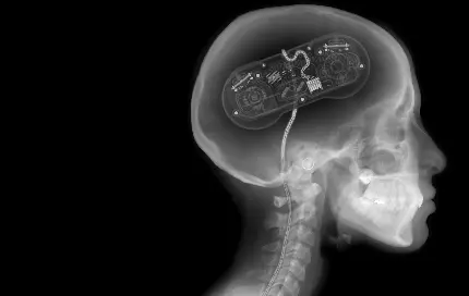 عکس رادیولوژی مغز با طرح فانتزی و سورئال