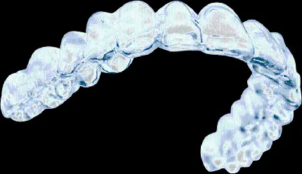 تصویر قالب ارتودنسی نامرئی دندان مخصوص پست اینستاگرام