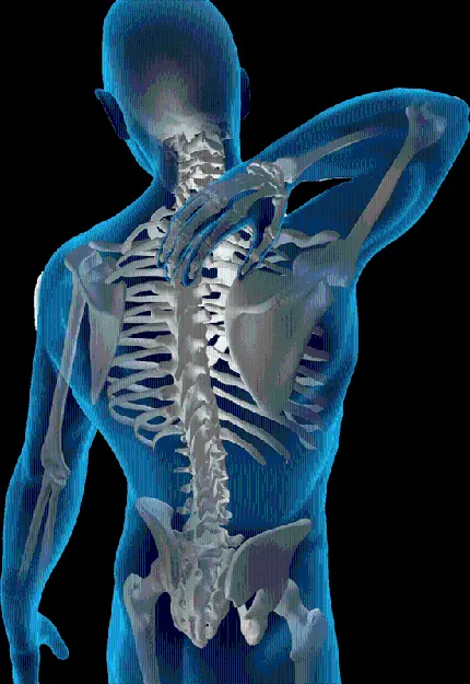 عکس رادیولوژی اسکلت بدن انسان برای چاپ مقالات مرتبط با فیزیوتراپی
