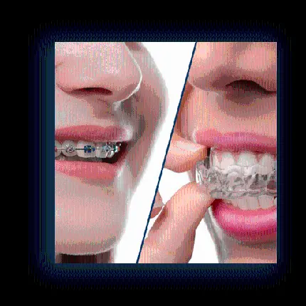 عکس پی ان جی انواع ارتودنسی های دندان با کیفیت اچ دی