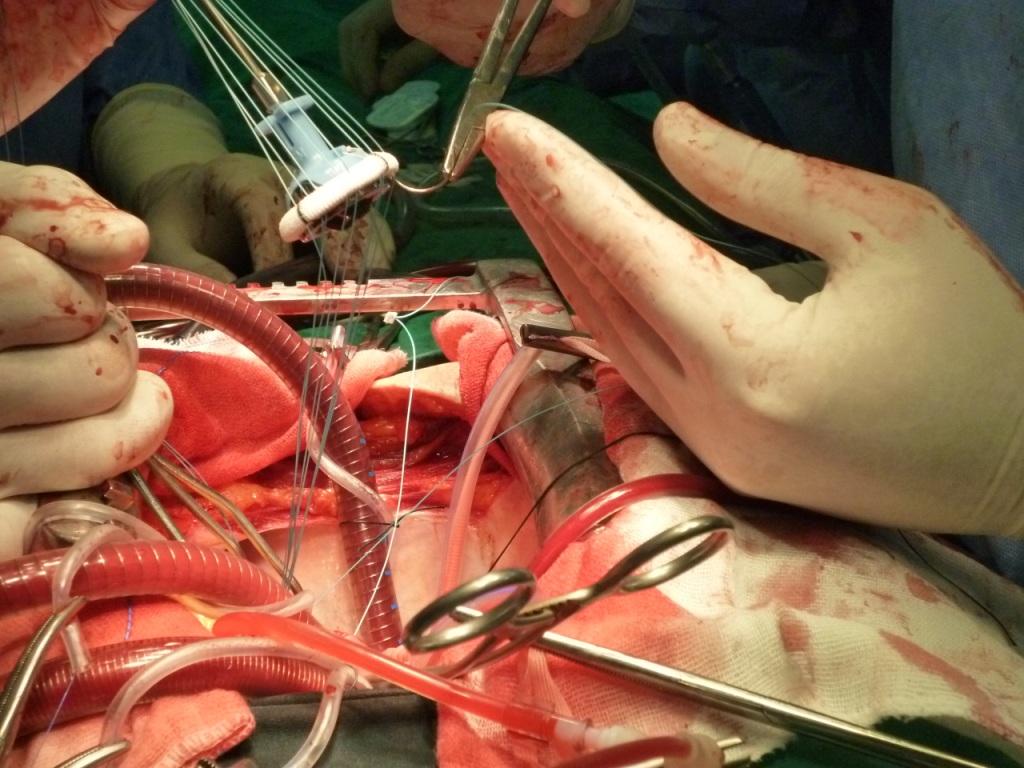 تصویر جدید عمل جراحی از فاصله نزدیک برای شبکه های اجتماعی