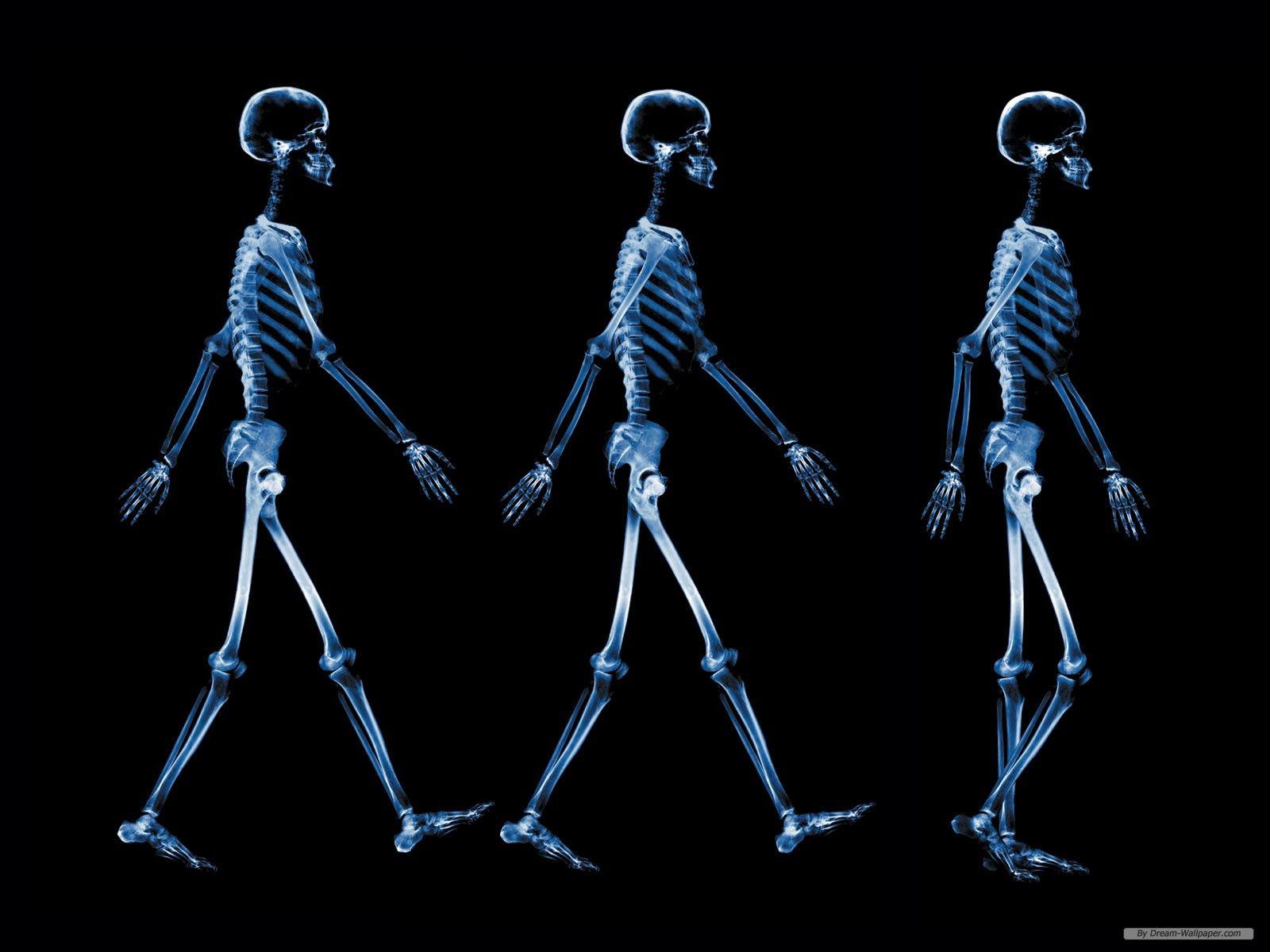 عالی ترین عکس رادیولوژی وضعیت استخوان ها هنگام راه رفتن 