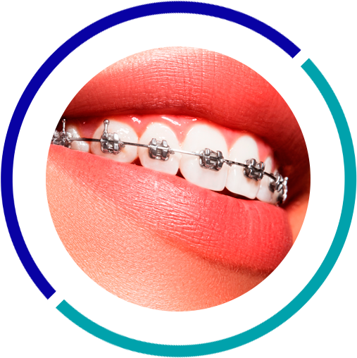 کاور هایلایت ارتودنسی دندان برای پیج دندان پزشکان