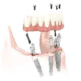 چاپ قاب موبایل و گوشی تصویر گرافیکی دور بری شده پی ان جی png دندان کیفیت بالا 