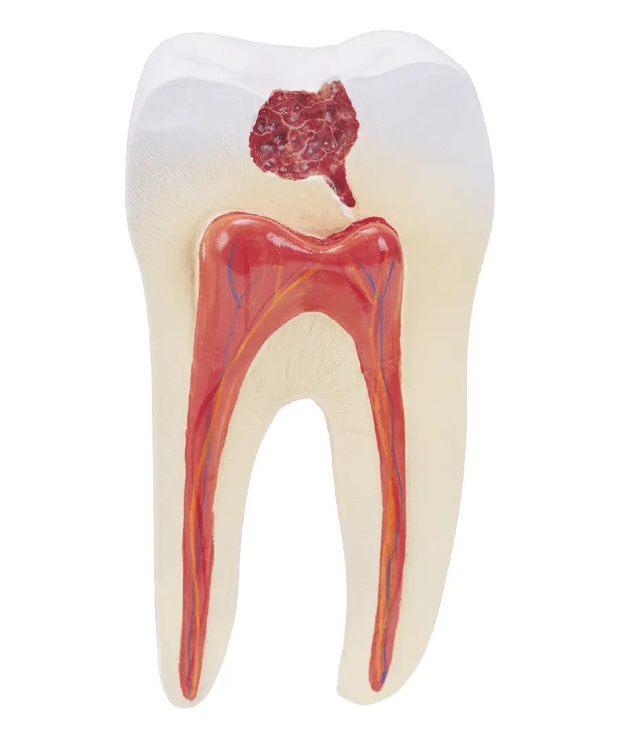 عکس مولاژ دندان و ریشه دندان با کیفیت بالا